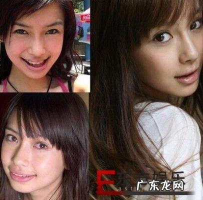 杨颖下巴整容前后 杨颖整容前