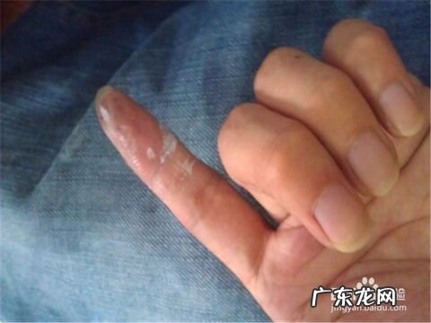 如何清除手上的胶水 手上粘胶水了怎么去掉