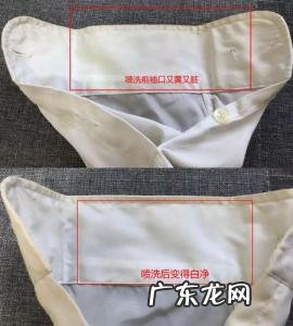衬衣领子发黄用什么洗 衬衣领子发黄怎么洗小窍门