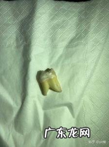 35岁拔智齿好不好 4颗智齿全拔了好不好