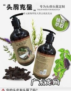 去屑止痒最好的洗发水,什么洗发水去头皮屑止痒效果最好