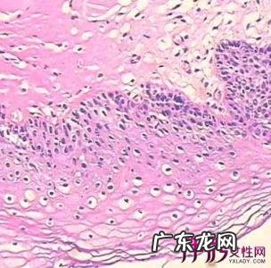 假性尖锐疣与真的照片 男性尖锐湿假性尖锐疣与真的照片